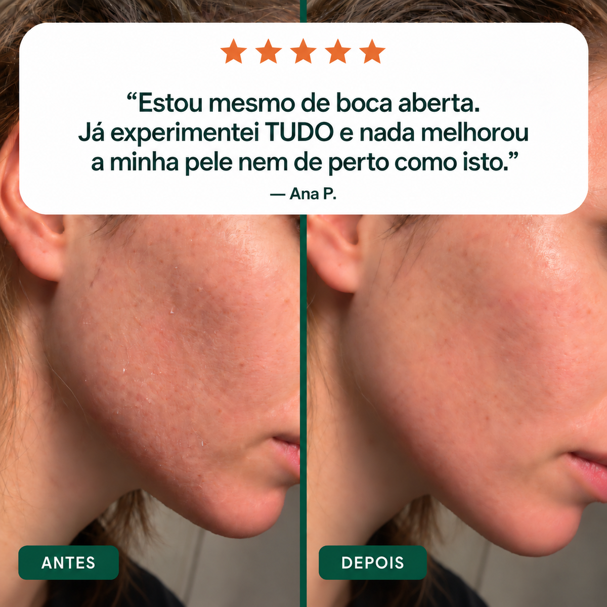 Castor Oil Ritual – antes e depois na pele, opinião Ana P.