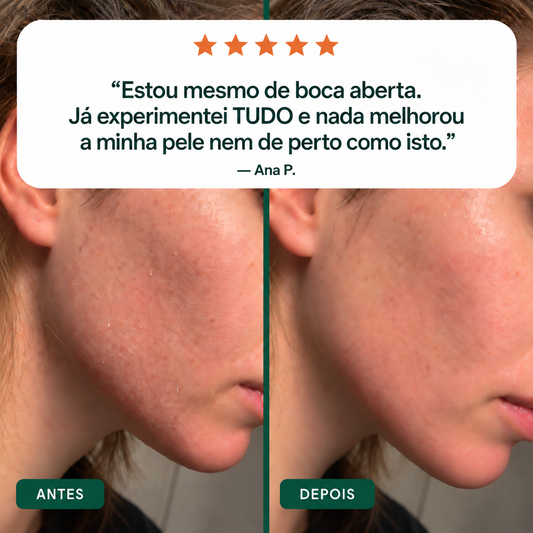 Castor Oil Ritual – antes e depois na pele, opinião Ana P. #pt